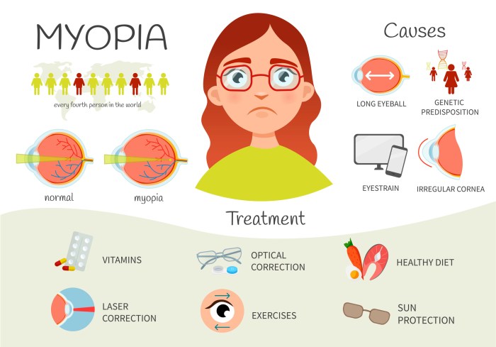 Myopia